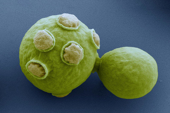 yeast.jpg