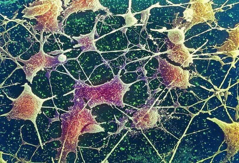 neuron-network.jpg